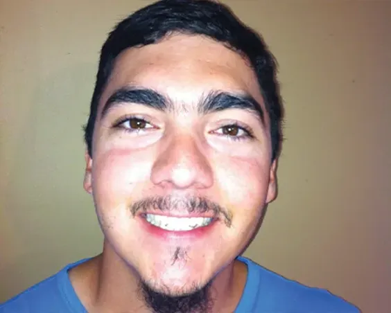 Patrick-Fonseca-1
